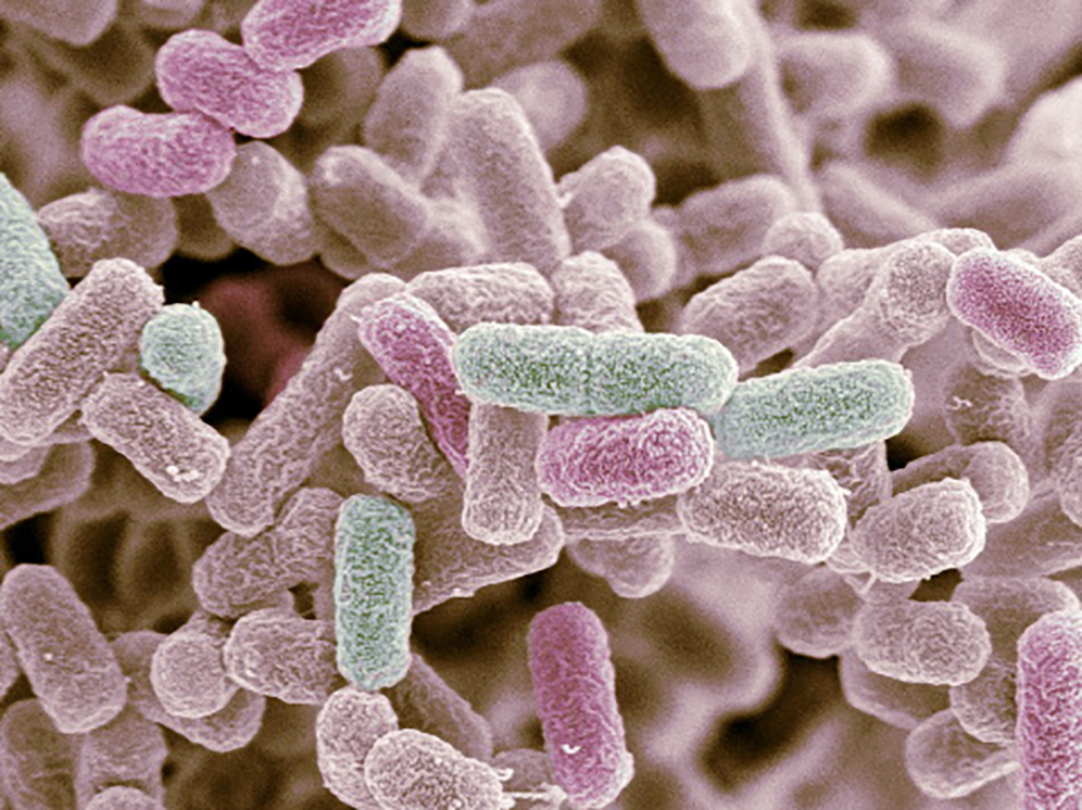 E. Coli