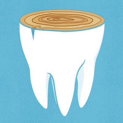 Illustration: sliced tooth showing tree rings