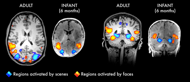 Graphic (Responses to faces and scenes in infants show adult-like spatial organization.)