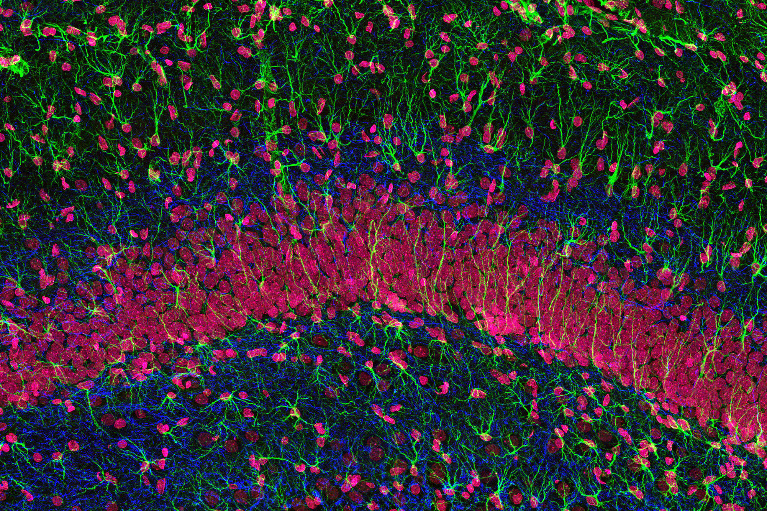 GFAP staining in glial cells, neurofilament protein in axons and DNA in cell nuclei