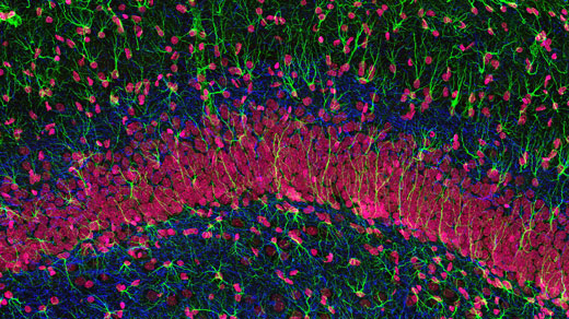 GFAP staining in glial cells, neurofilament protein in axons and DNA in cell nuclei