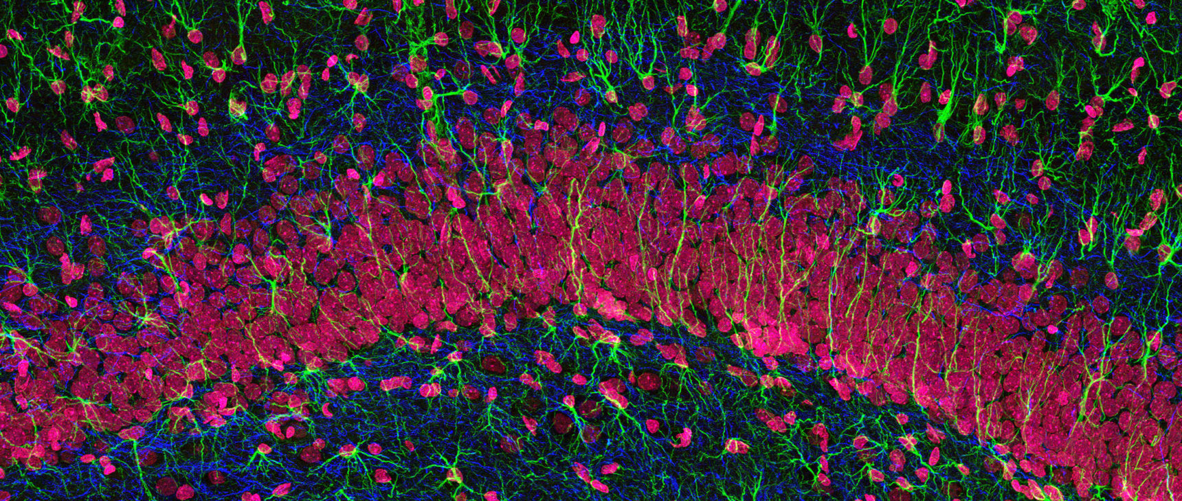 GFAP staining in glial cells, neurofilament protein in axons and DNA in cell nuclei