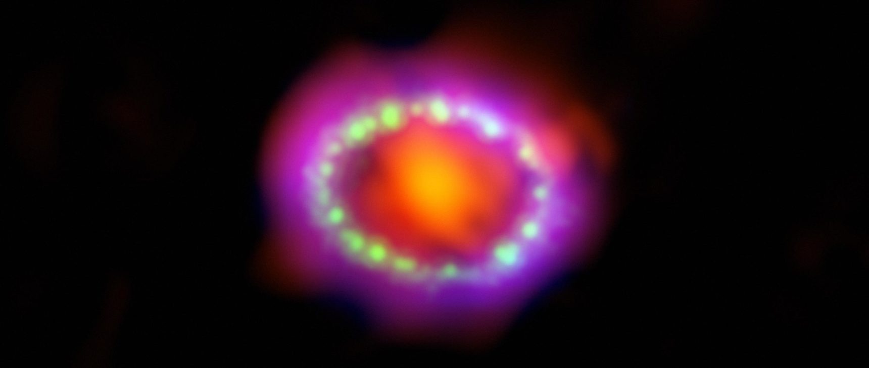 Supernova 1987A remnants