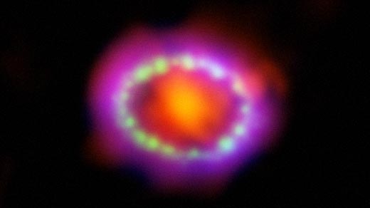 Supernova 1987A remnants