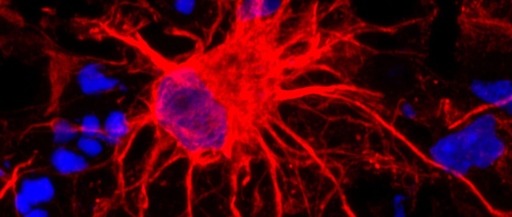 Neurons and astrocytes