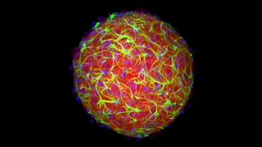 cerebral organoid, or mini-brain