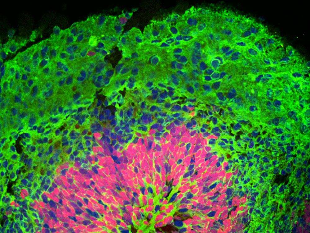 stained cross section through a cortical organoids