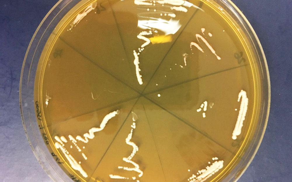 Budding yeast (S. cerevisiae)