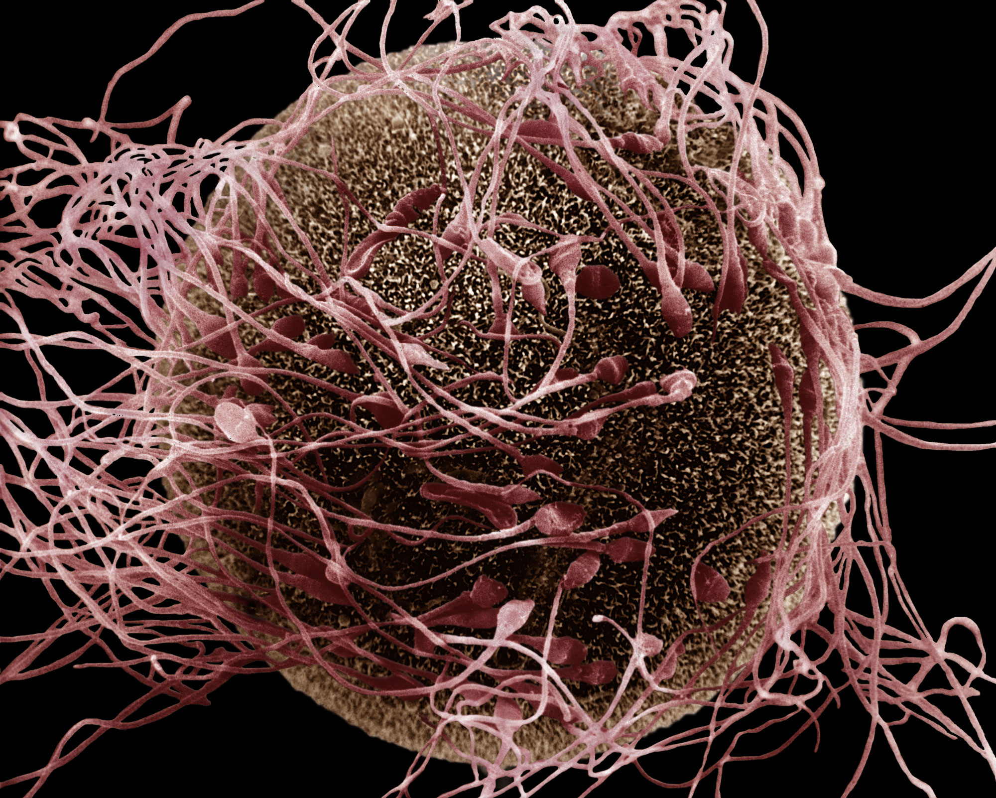 A scanning electron micrograph shows the moment of fertilization involving a human egg and spermatozoa. Historically, the egg has often been portrayed as passive while the sperm jockey in competition, but new findings suggest that the egg may screen out sperm with unsuitable genes.