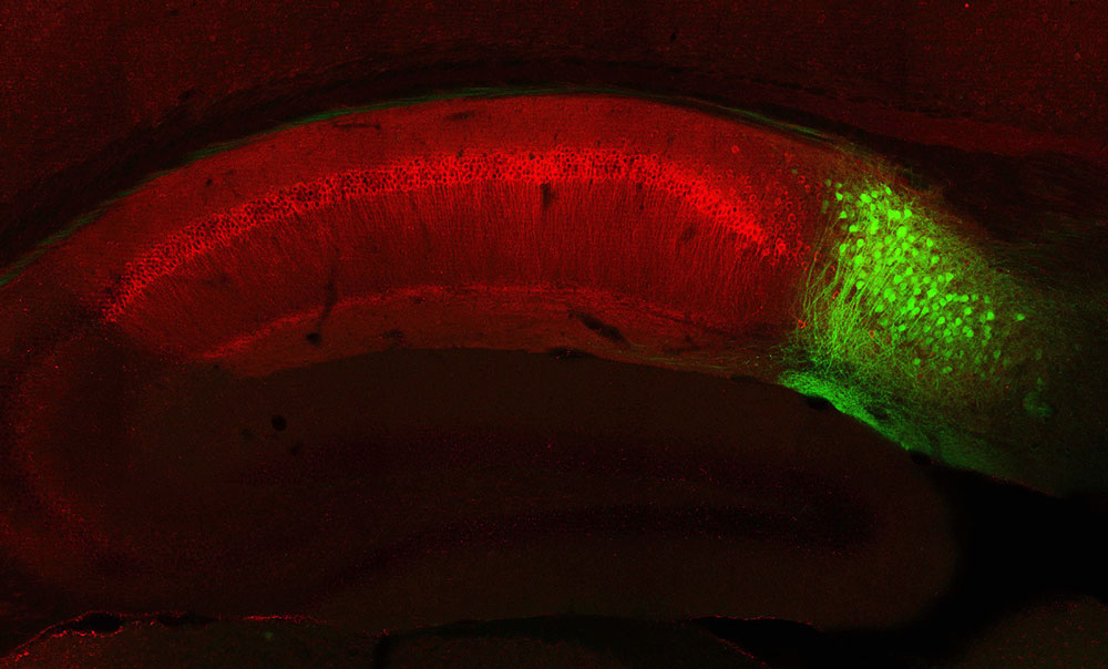 subiculum