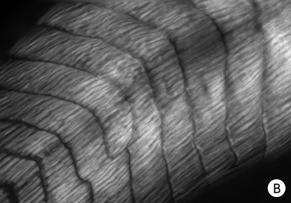 Photo of muscle development in brainless tadpole embryos