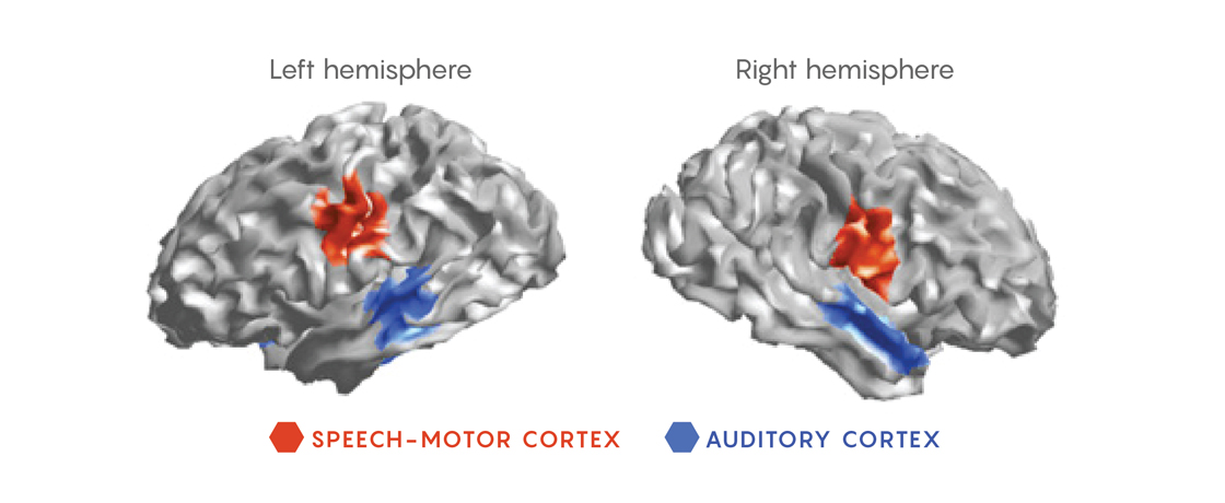 Image of the brain showing the speech-motor cortex and the auditory cortex regions