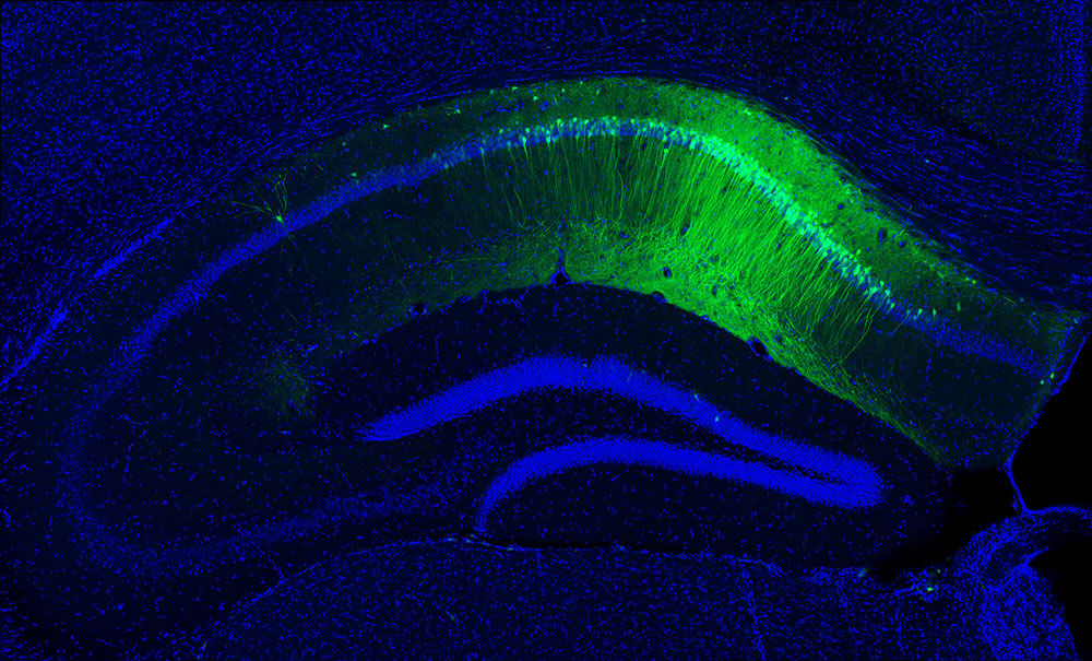 Photo of magnified Hippocampal-CA1 of a mouse.