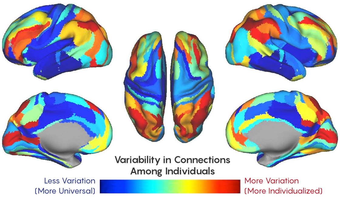 Different angles of brain scans showing variability in connections among individuals