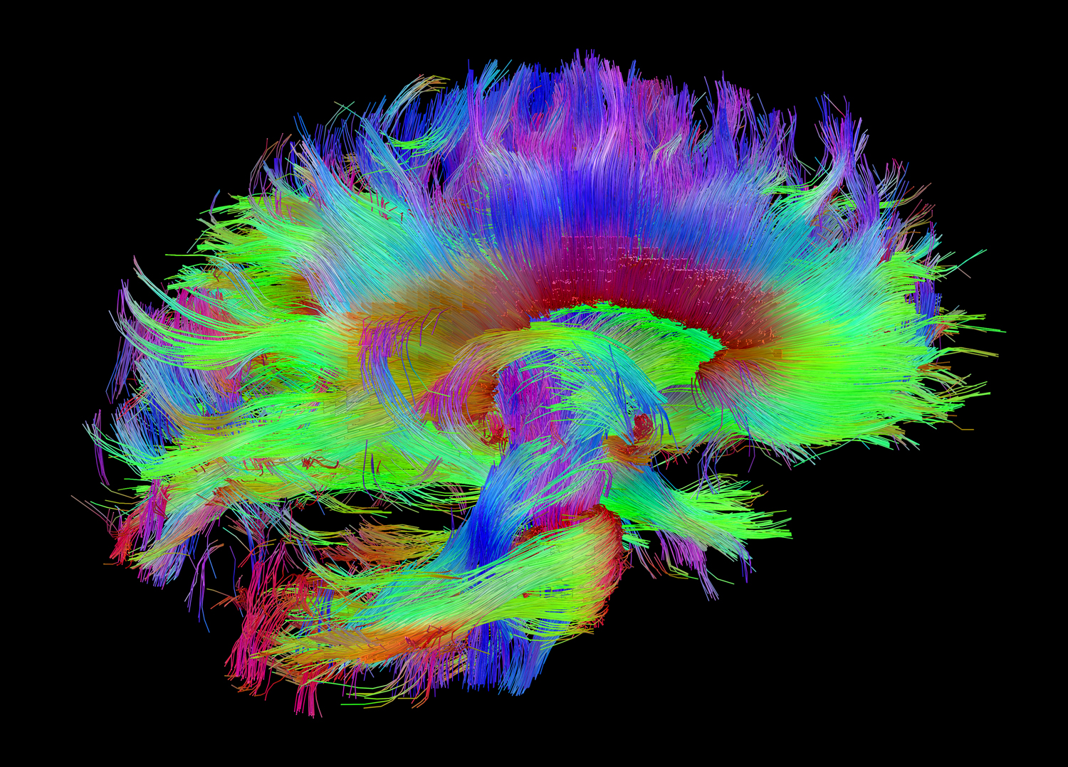 Image of a brain scan