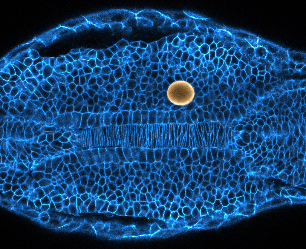 PHOTO OF BLUE EMBRYO WITH YELLOW DOT