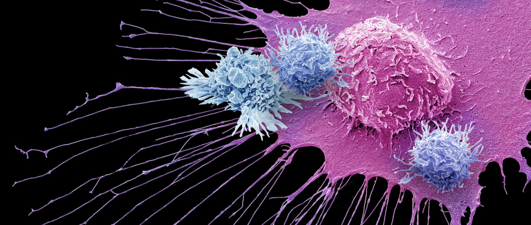 Art for "Nobel Prize Awarded for Cancer Immunotherapy"