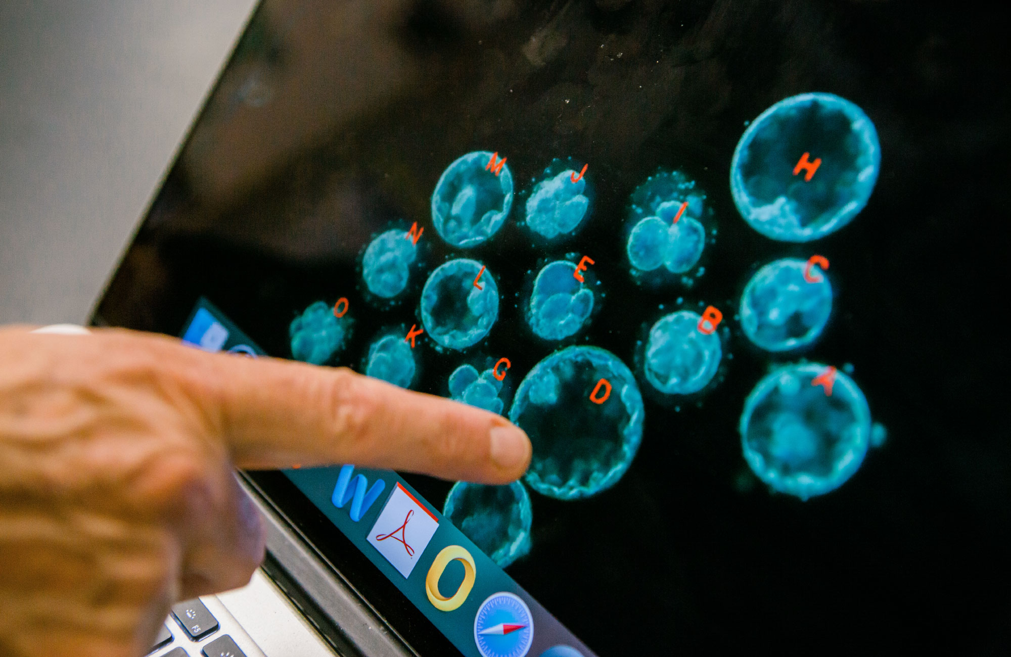 Pera pointing to embryos on a computer screen.