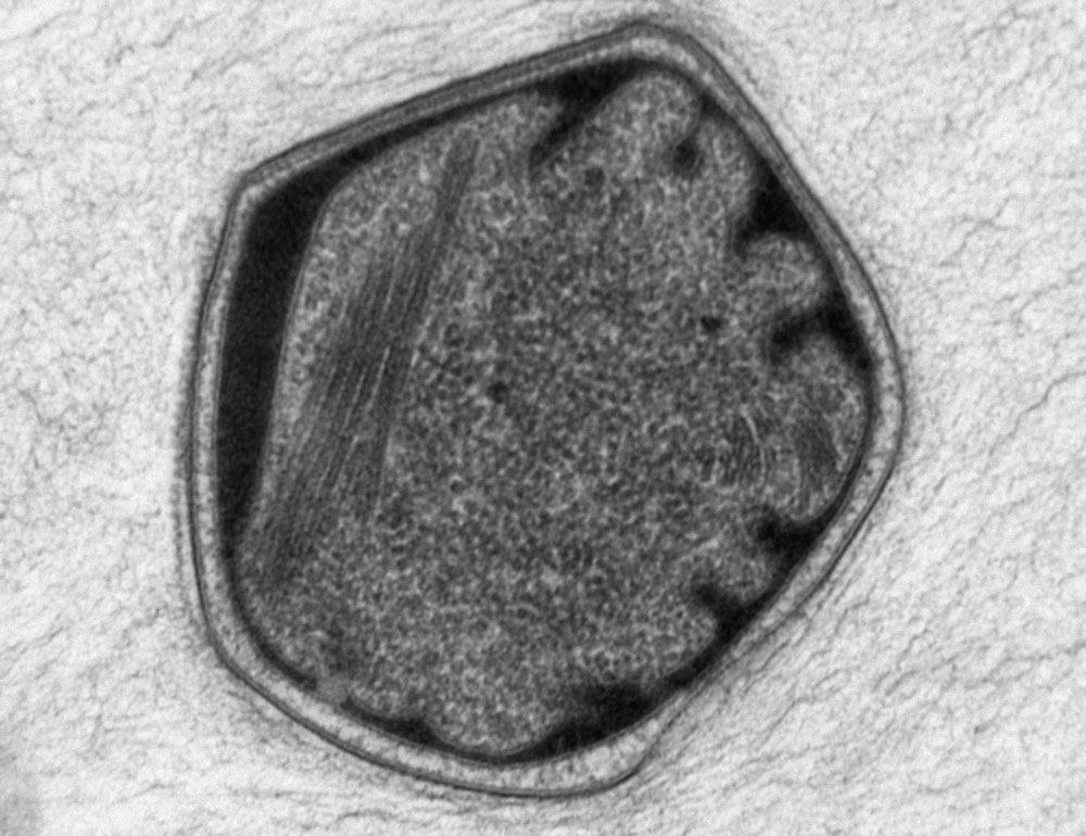 Black and white microscopic image of an Anammoxosome