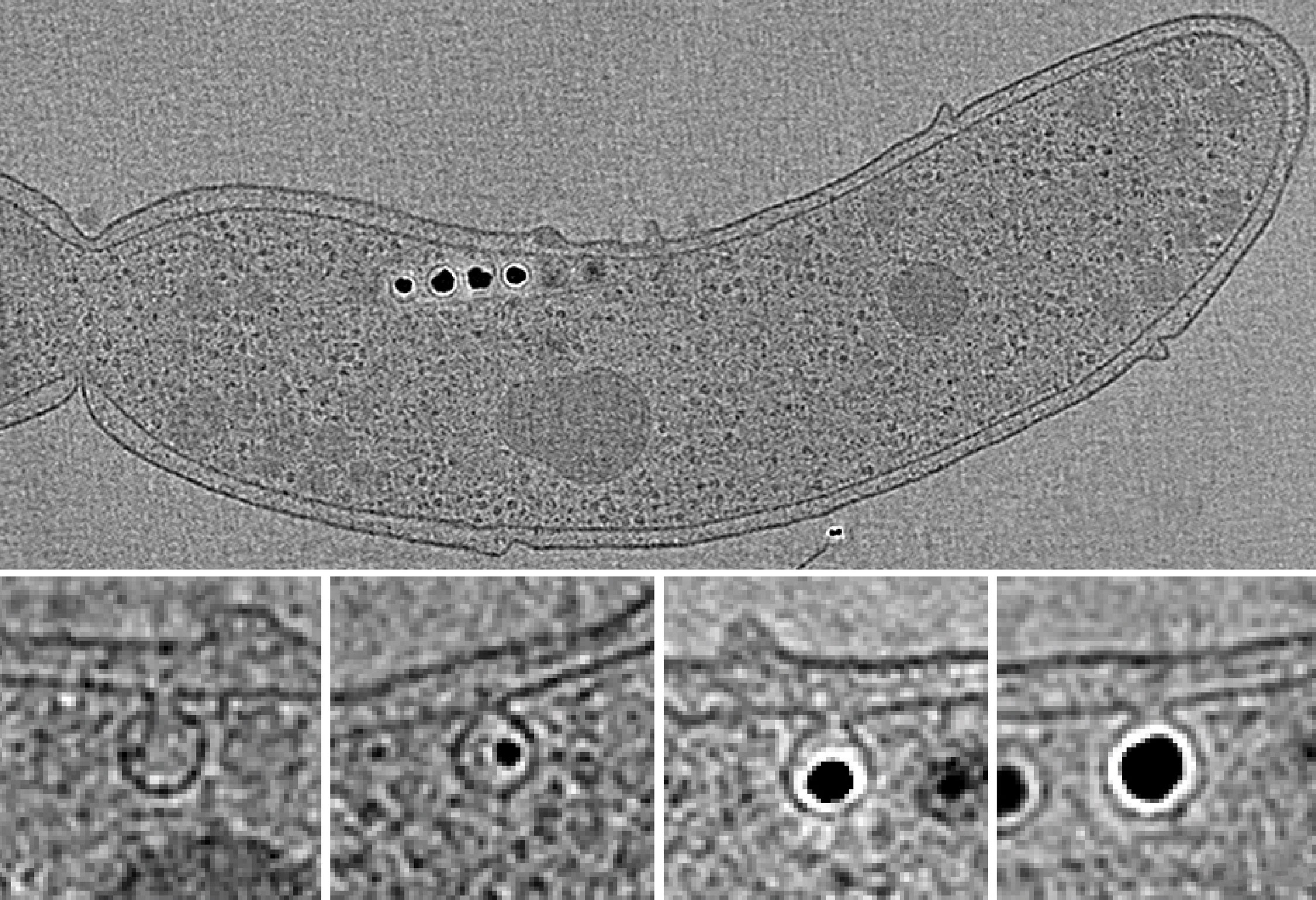 Black and white microscopic imaging of Magnetosomes