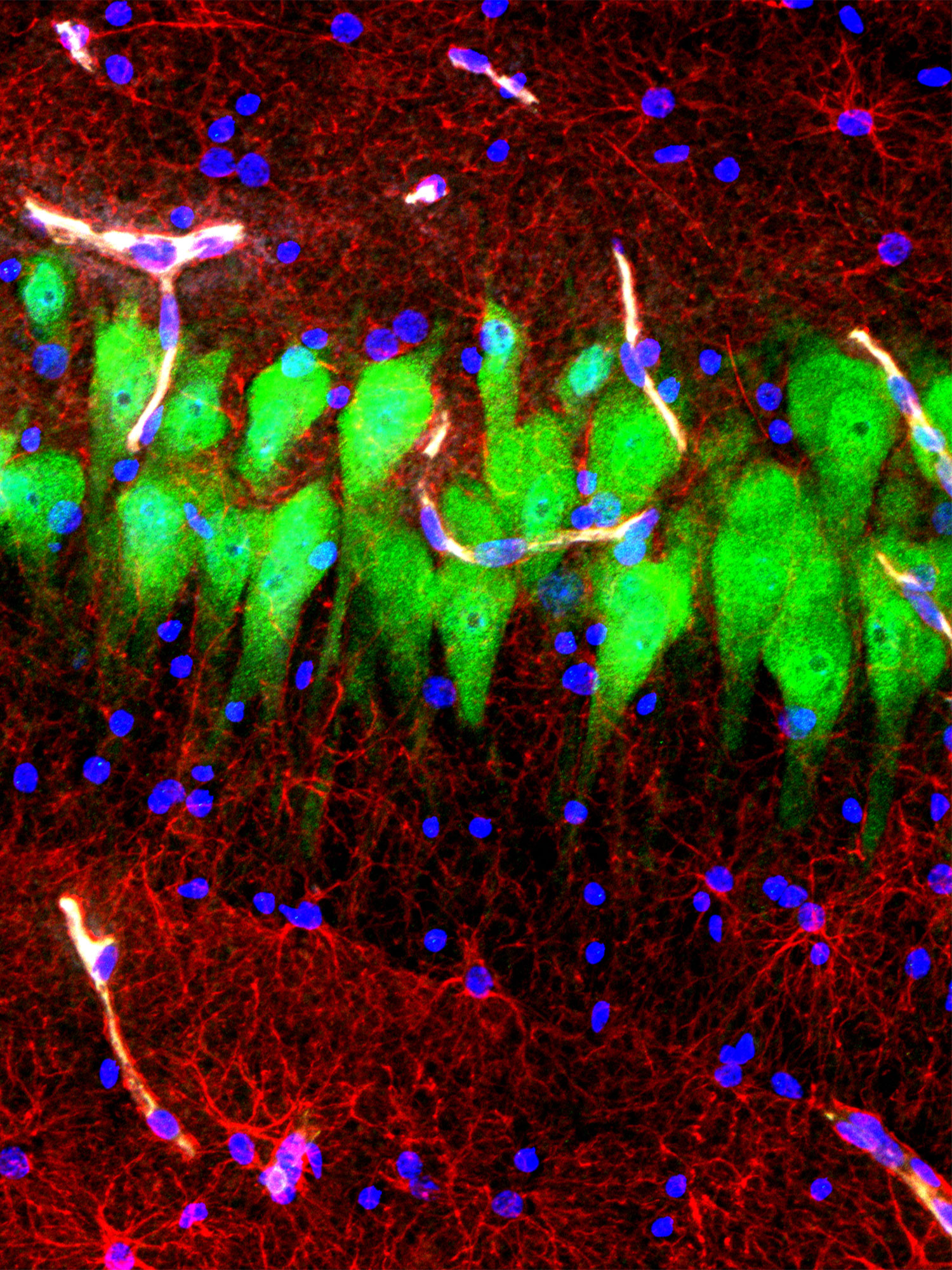 MICROGRAPH OF CELLS AFTER BRAINEX