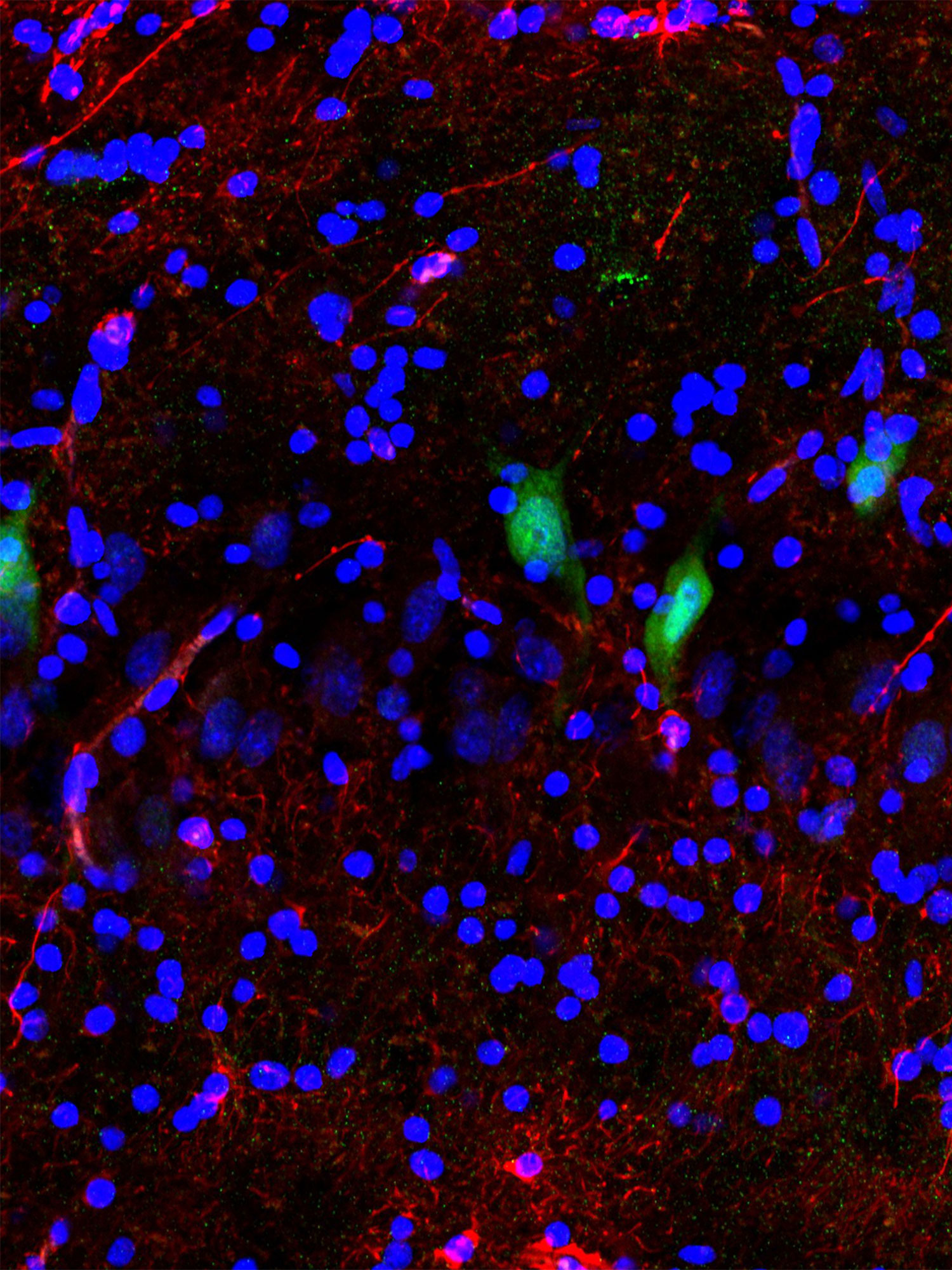 MICROGRAPH OF CELLS BEFORE BRAINEX