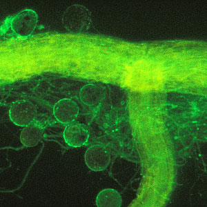 Root glowing green against black background. Small spheres and threadlike filaments surround it.