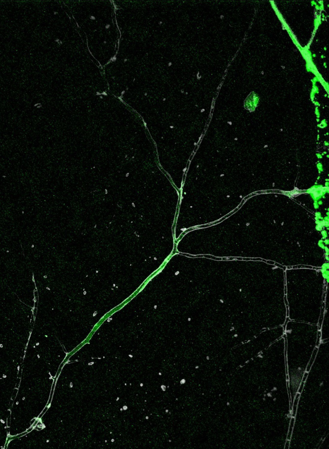 Green spots from fluorescing quantum dots fill and partially outline fungal hyphae.