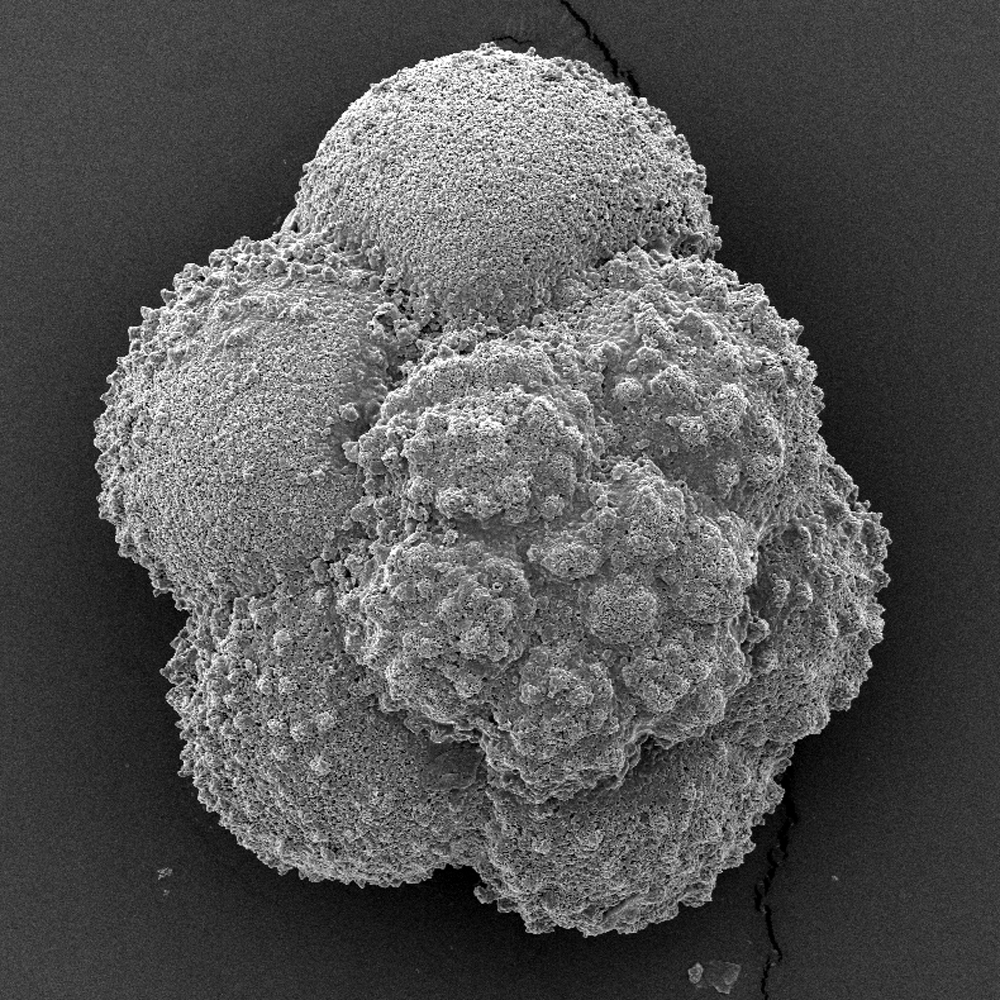 Photomicrographs of ancient calcifying plankton.