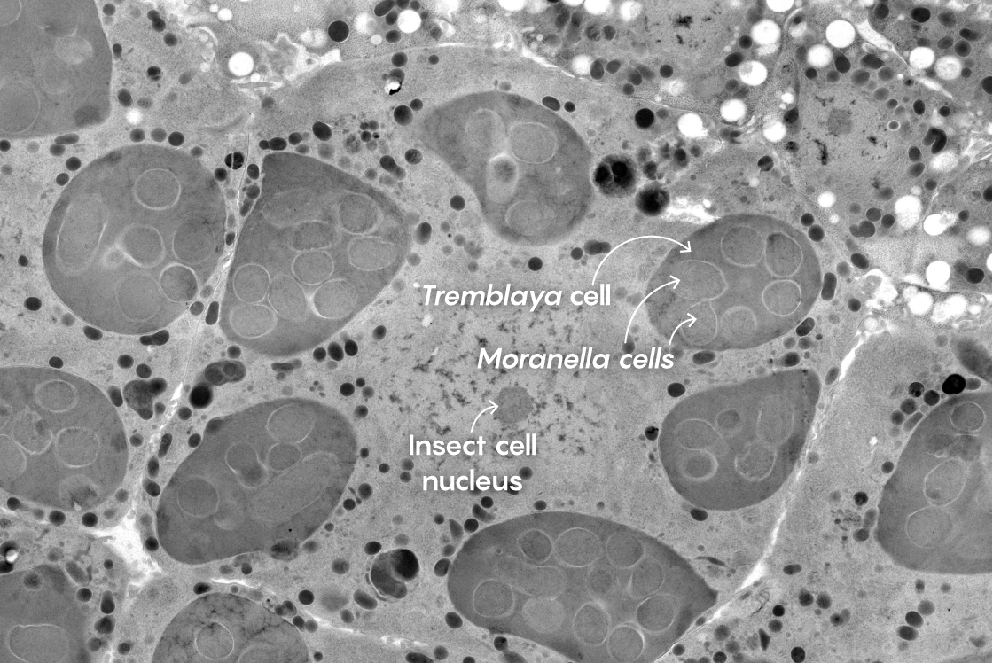 Micrograph of mealybug cell with endosymbionts inside it.