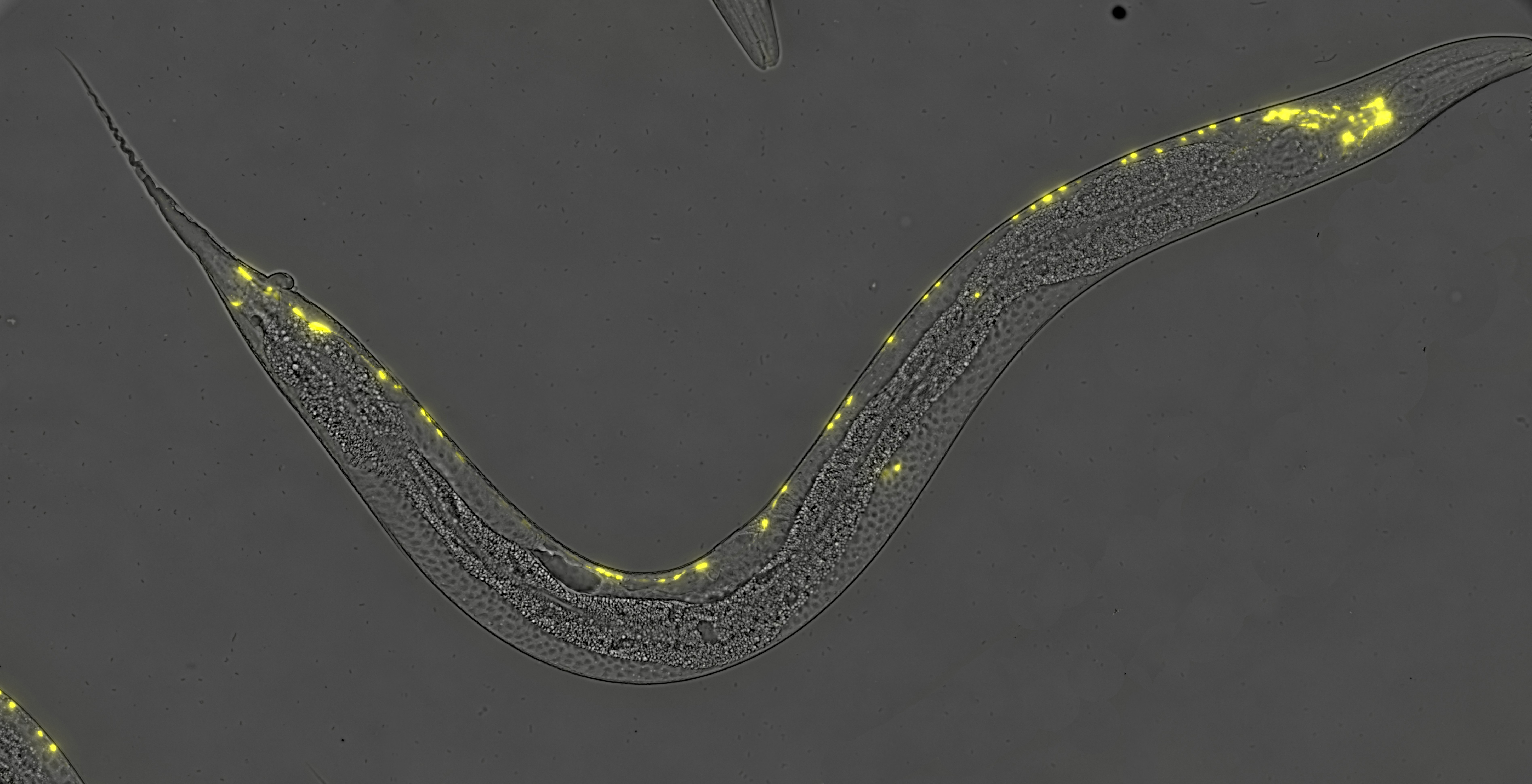 Micrograph of a roundworm with yellow highlights marking the location of its neurons.