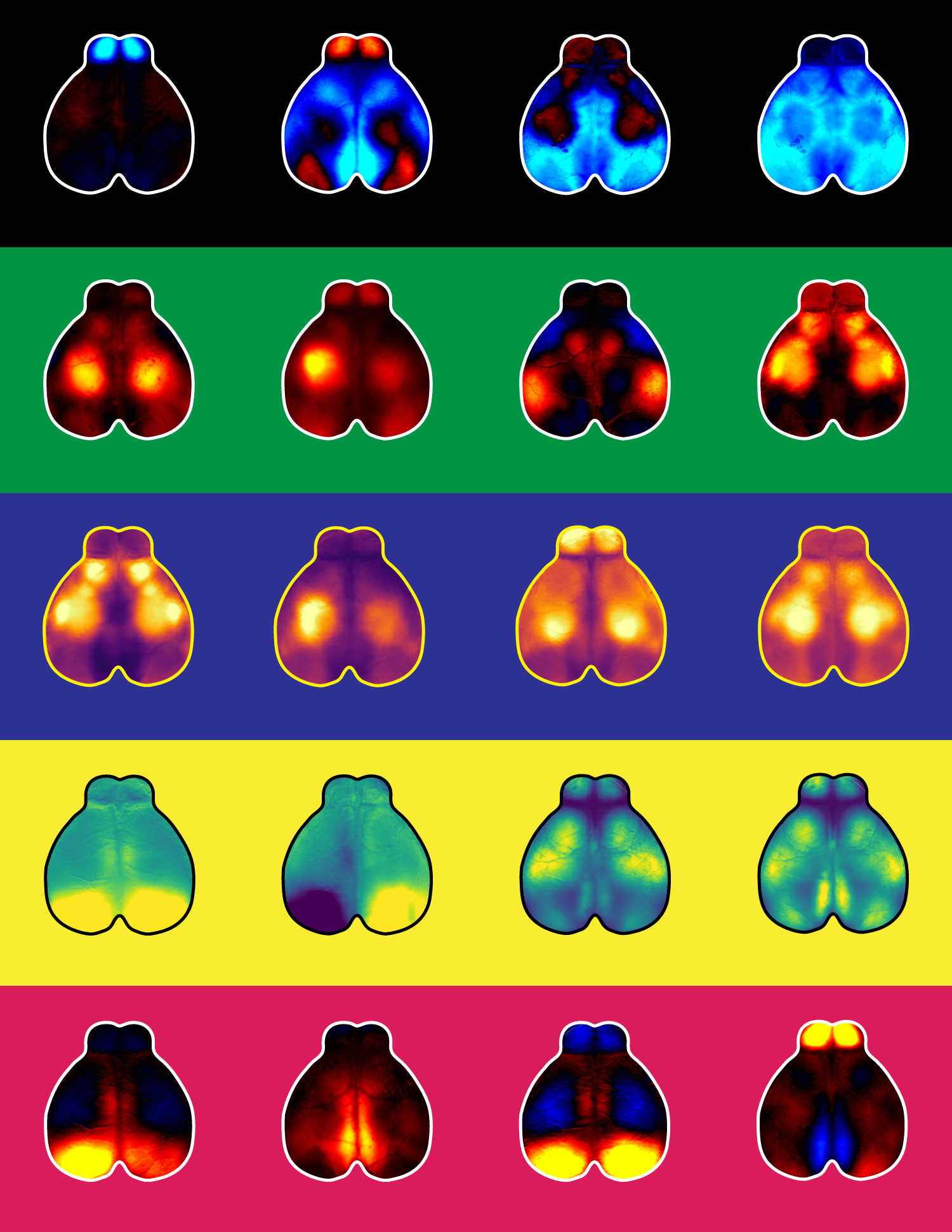 A brightly colored grid of brain scans, each of which shows widely distributed activity.