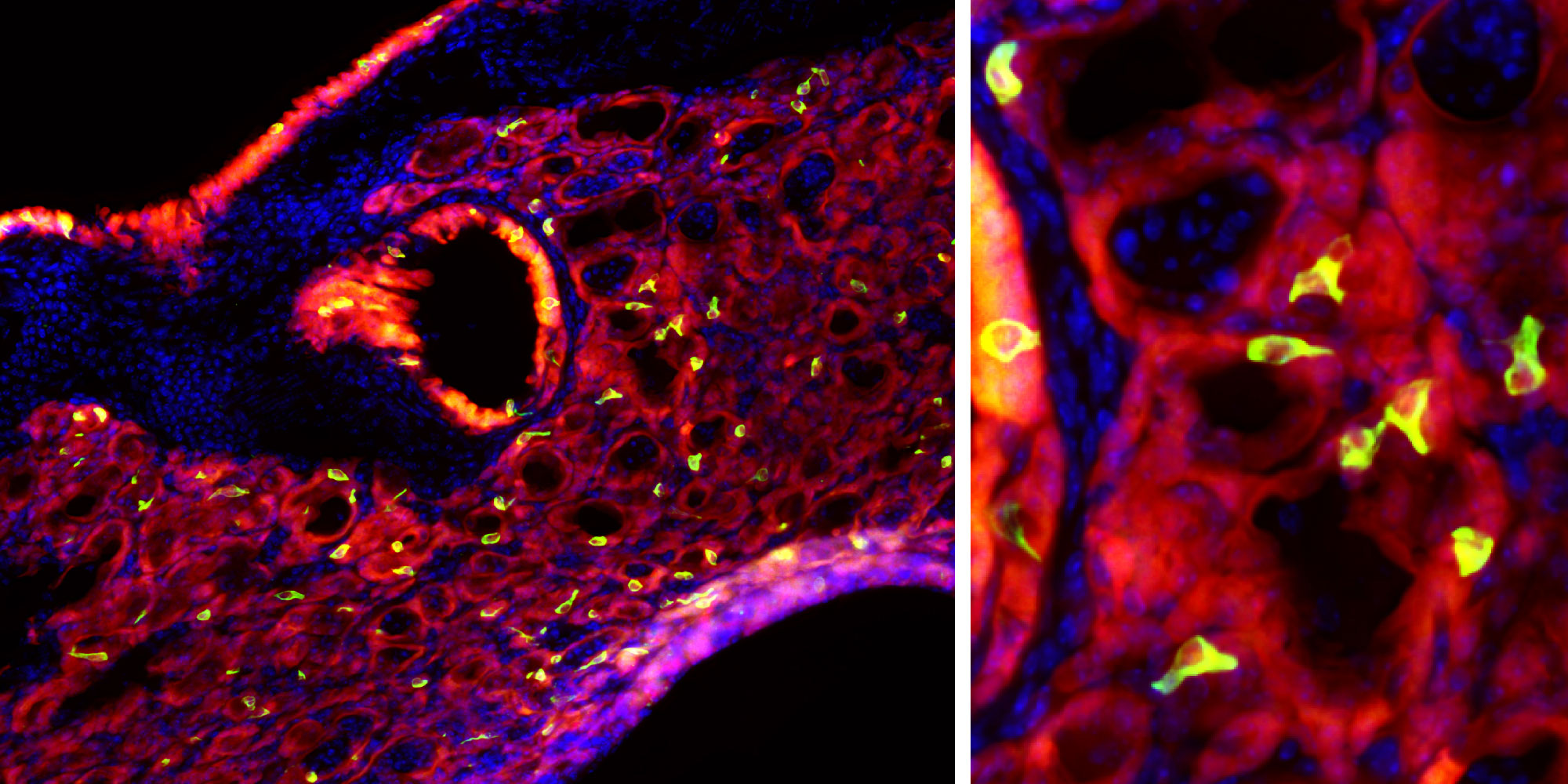 Two micrographs of mouse lung tissue, showing tuft cells in yellow. The righthand image is a closeup of the center of the one on the left.