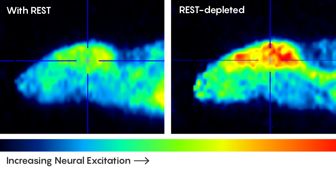 PET-CT scans of mice show that more neural activity is present in mice that are deficient in the REST protein.