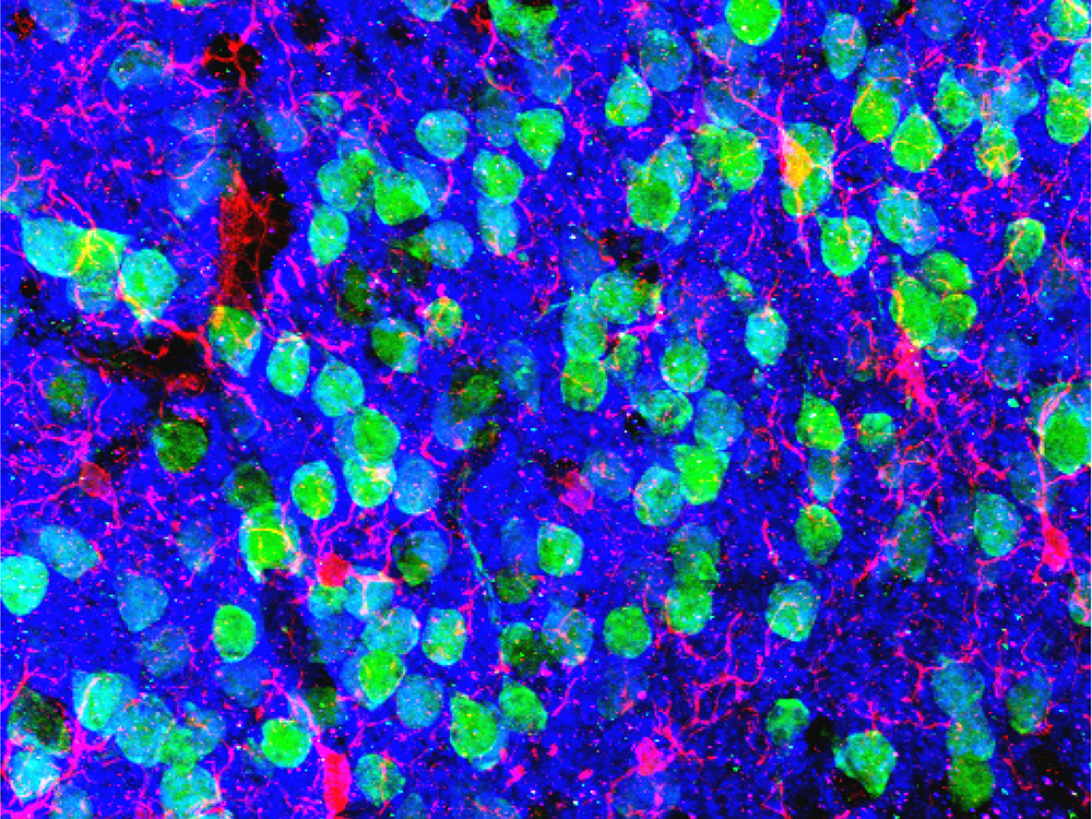 Micrograph of medial prefrontal cortex, showing green neurons and red microglia.