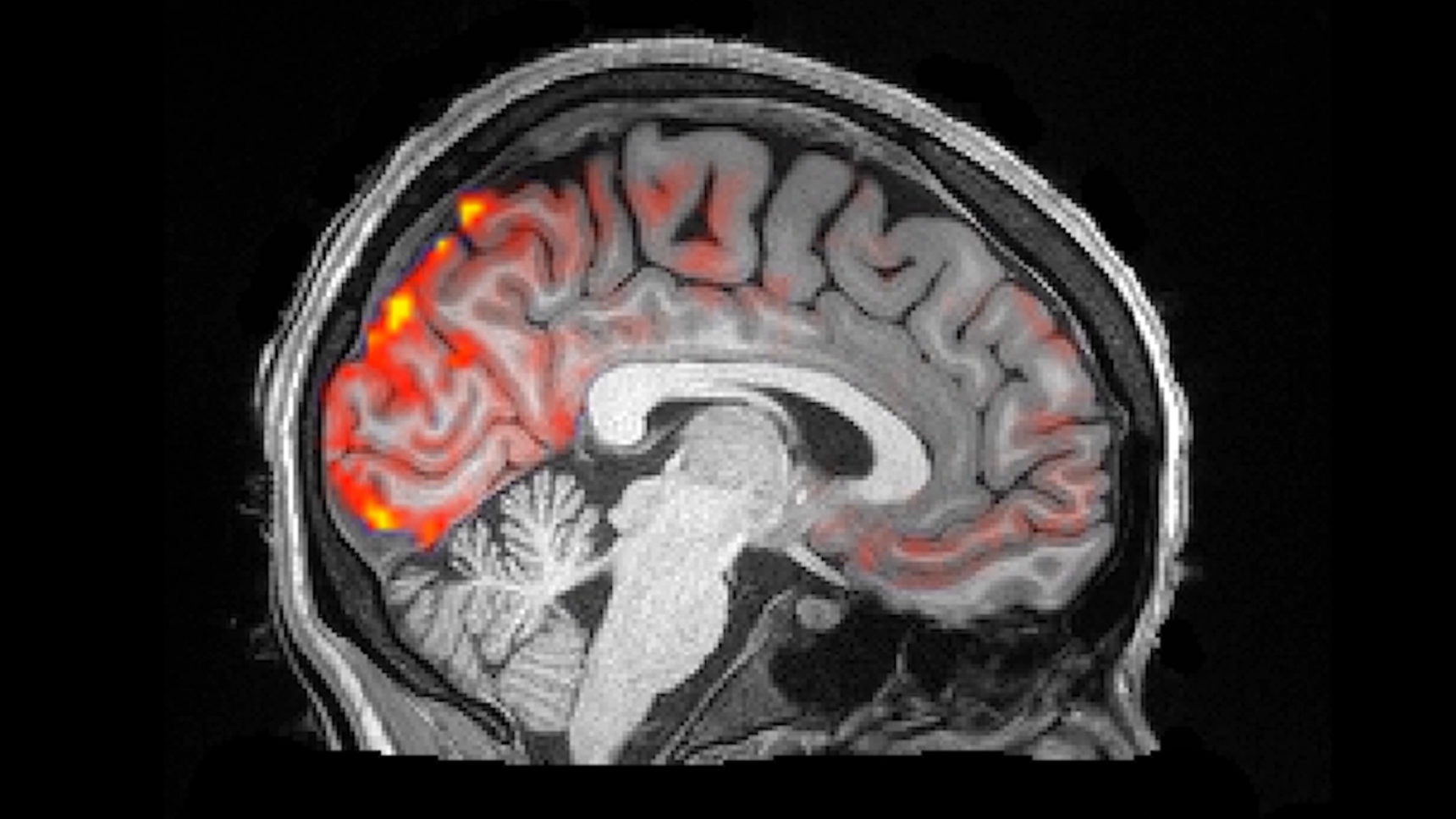 MRI video of blood and cerebrospinal fluid moving through a sleeping brain.