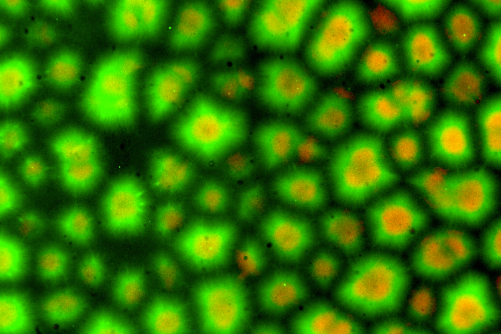 One of two images of cytoplasmic compartmentalization results. .