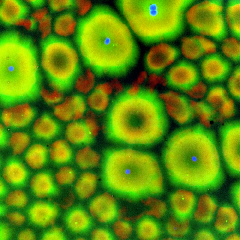 One of two images of cytoplasmic compartmentalization results. .