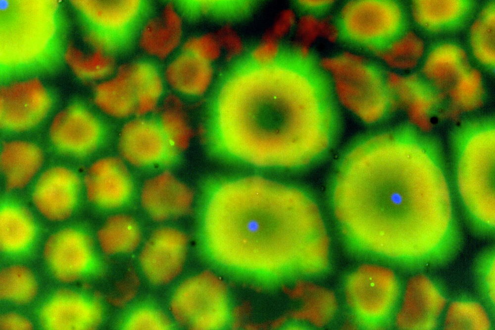 One of two images of cytoplasmic compartmentalization results. .