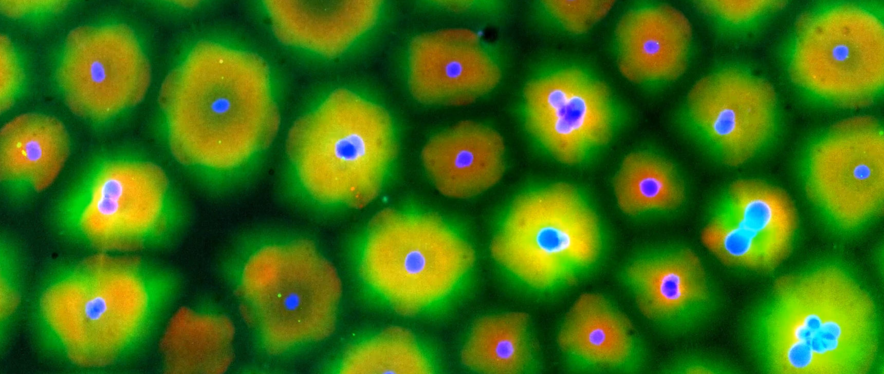 A nearly homogeneous field of yellow cytoplasm spontaneously compartmentalizes itself into clumps around the dots of nuclei.