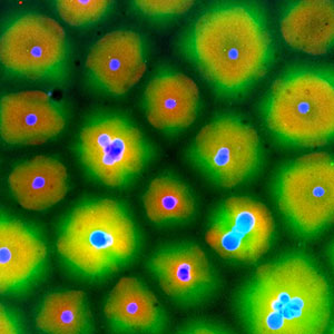 A nearly homogeneous field of yellow cytoplasm spontaneously compartmentalizes itself into clumps around the dots of nuclei.