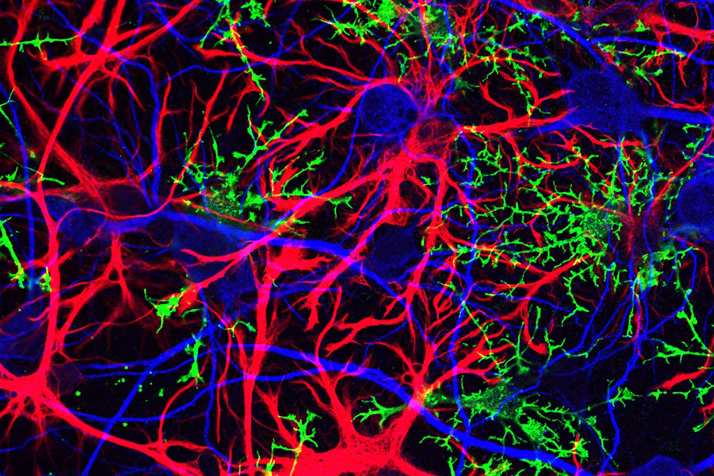 A magnified field of various cells in the brain that are stained different colors.