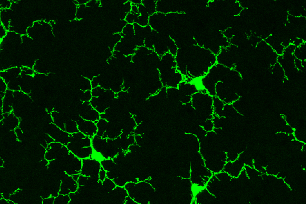 Many-armed green cells with complex shapes on a black background.