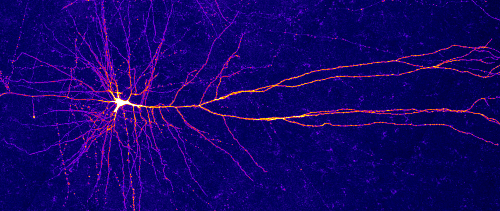 Micrograph of a cortical neuron, showing its many dendrites.