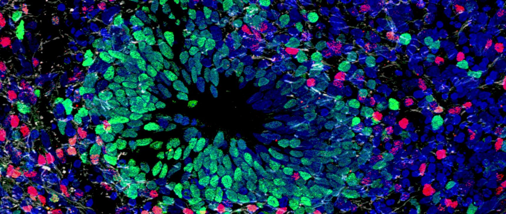 Micrograph of a section of brain organoid tissue.