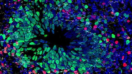 Micrograph of a section of brain organoid tissue.