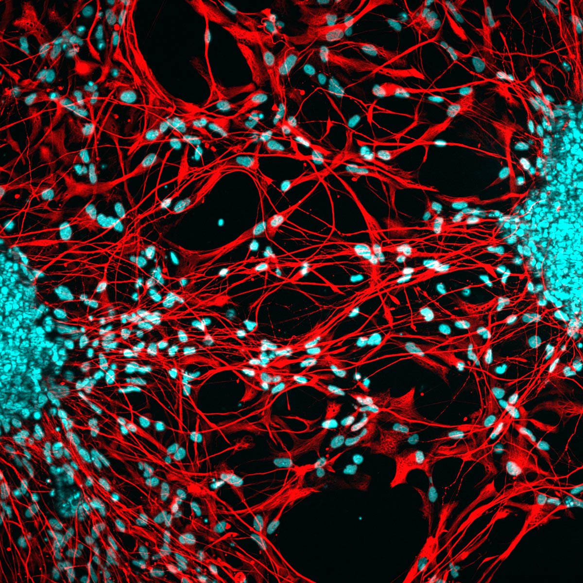 Image of an organoid