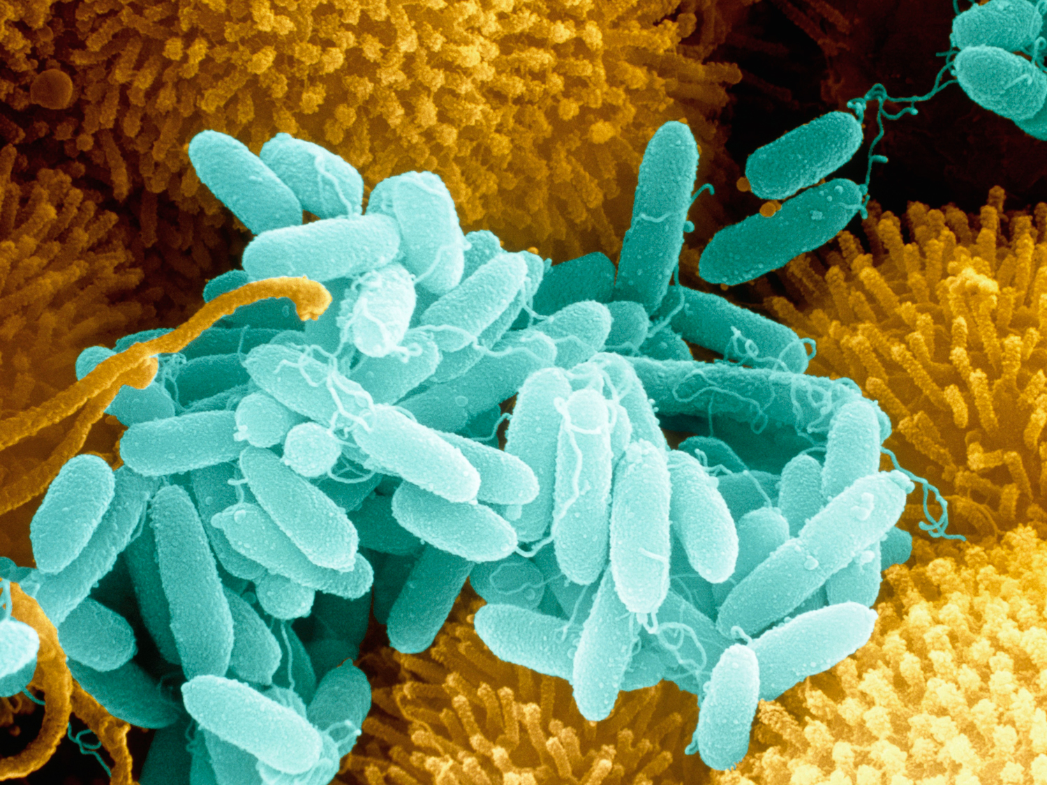 Green capsule-shaped cells grow on larger orange ciliated cells.