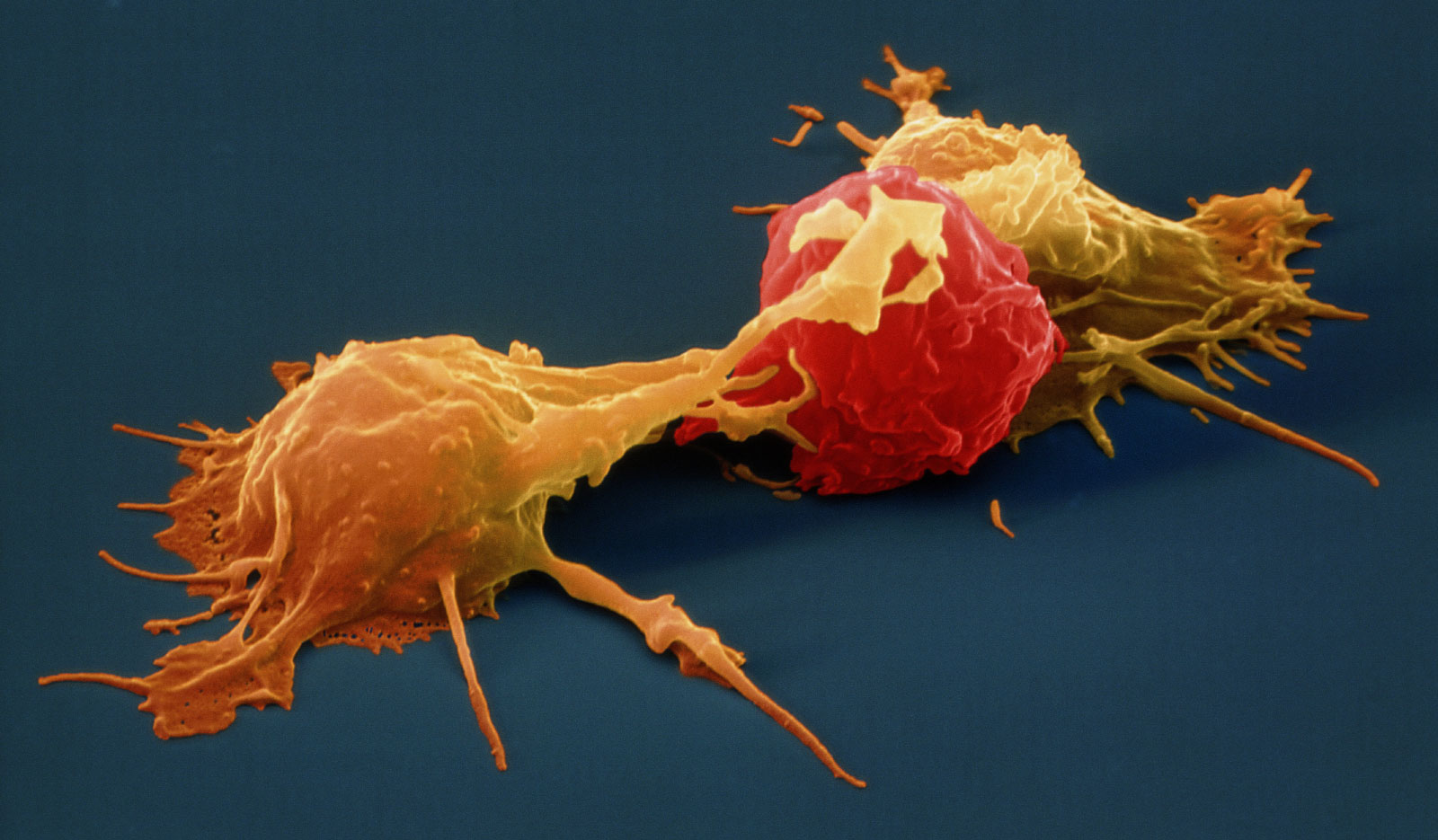 Two natural killer cells attack a tumor cell.