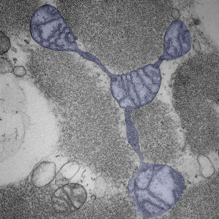 Micrograph shows thin connections between mitochondria.